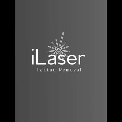 iLaser Tattoo Removal photo